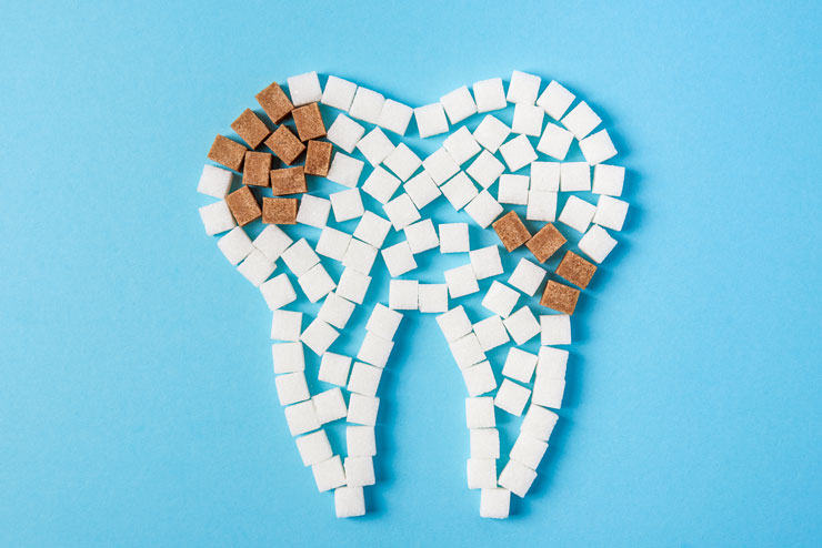 caries detection, cavity photo illustration