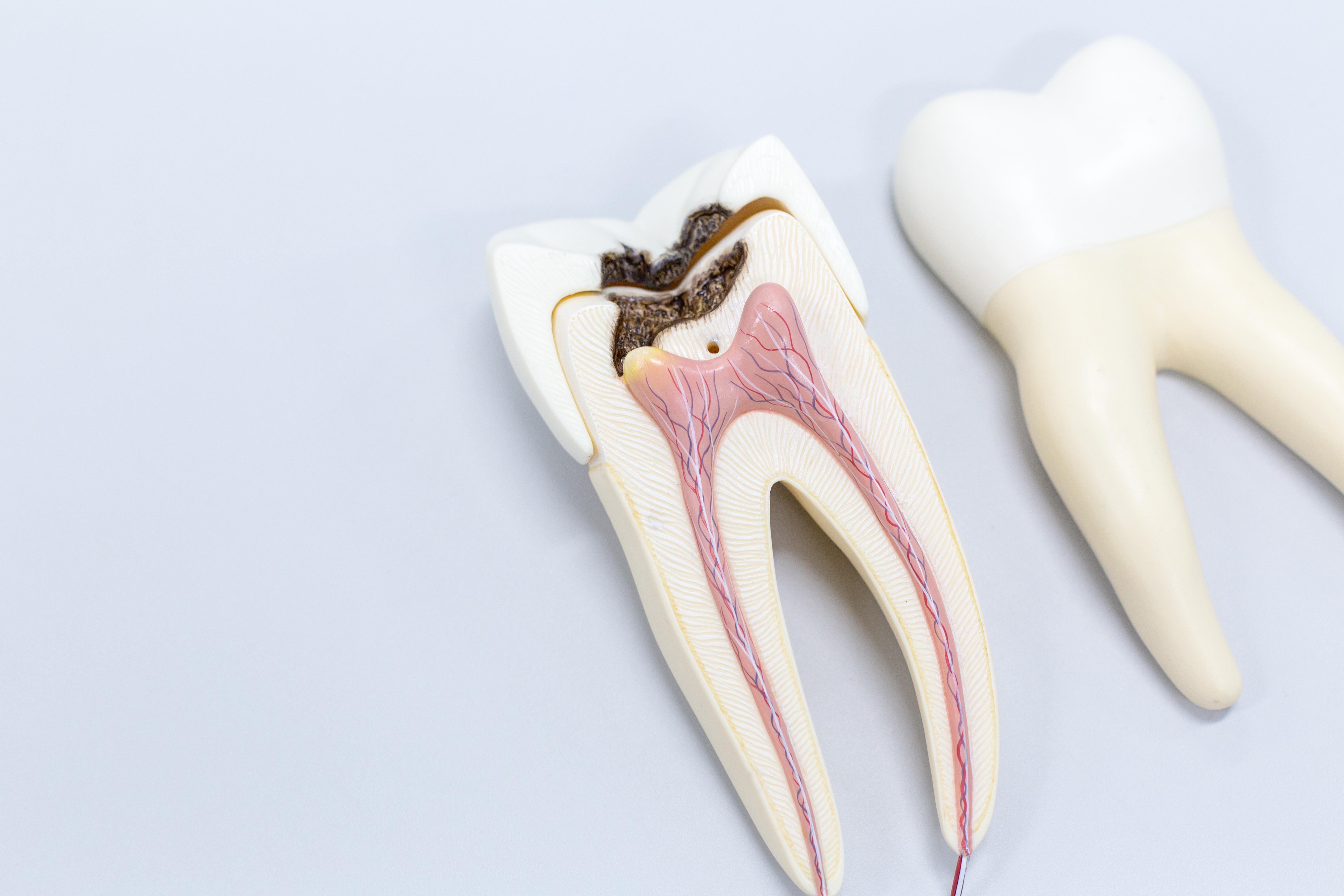 健康・医学 Vital Pulp Therapy Saving Teeth Through Vital Pulp Therapy - Zyris - Makers of the